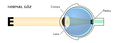normal göz